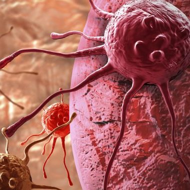 Cancer Overview and Treatment