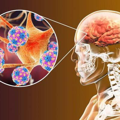 Neurodegenerative Diseases