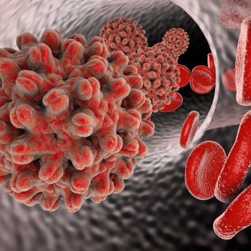 Hepatitis is a viral infection that affects the liver