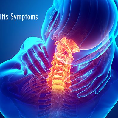 Understanding Radiculitis: Causes, Symptoms, and Treatment Options