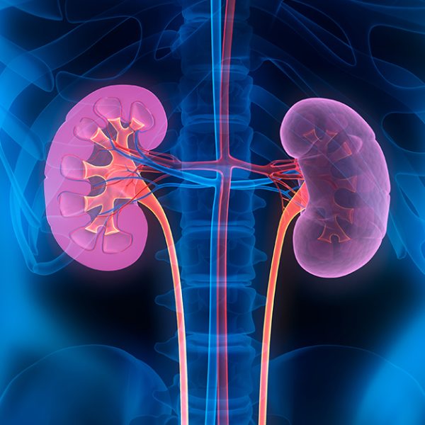 Chronic kidney disease
